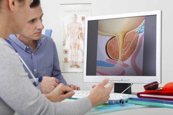 the doctor consults the patient on the subject of prostatitis
