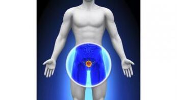 prostatitis in a man