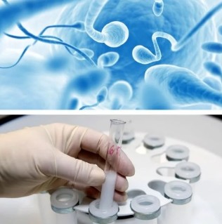 Sperm